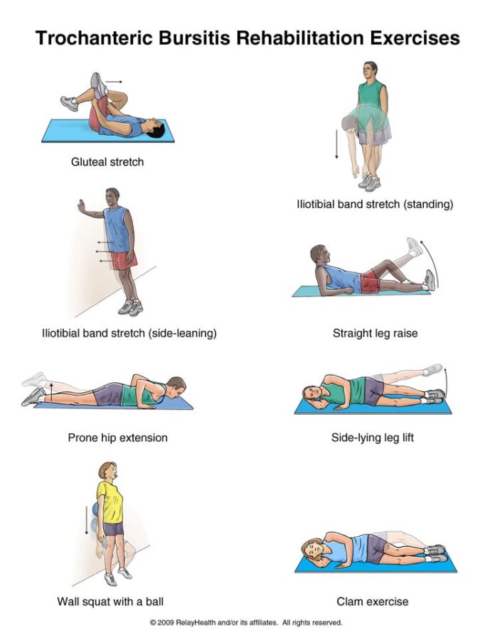 Trochanteric Bursitis Exercises for Pain Relief