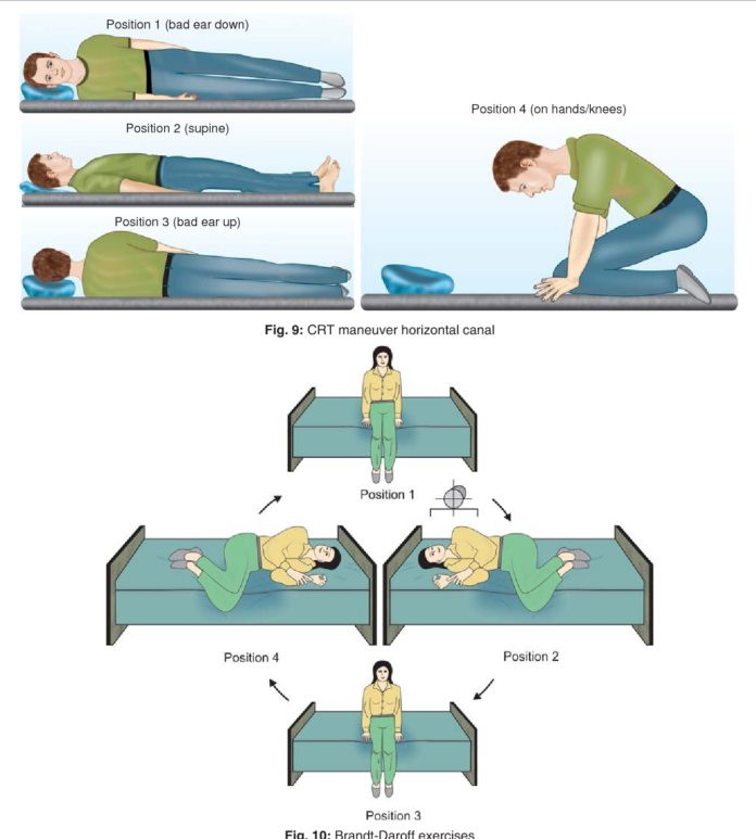 Vestibular Exercises for Better Coordination and Focus